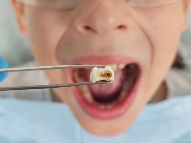 Best Emergency Pediatric Dental Care in Walterboro, SC